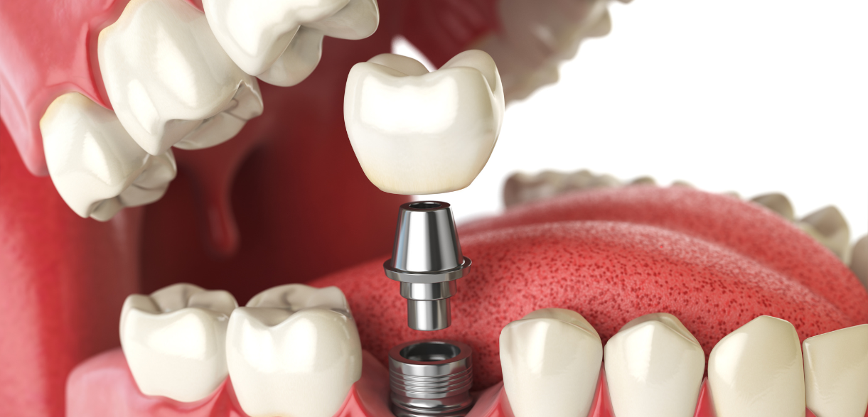 prioritize dental cleanings