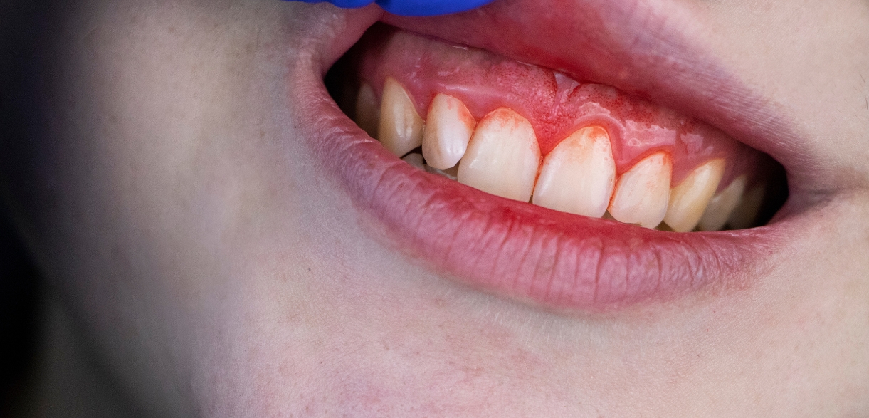 prioritize dental cleanings
