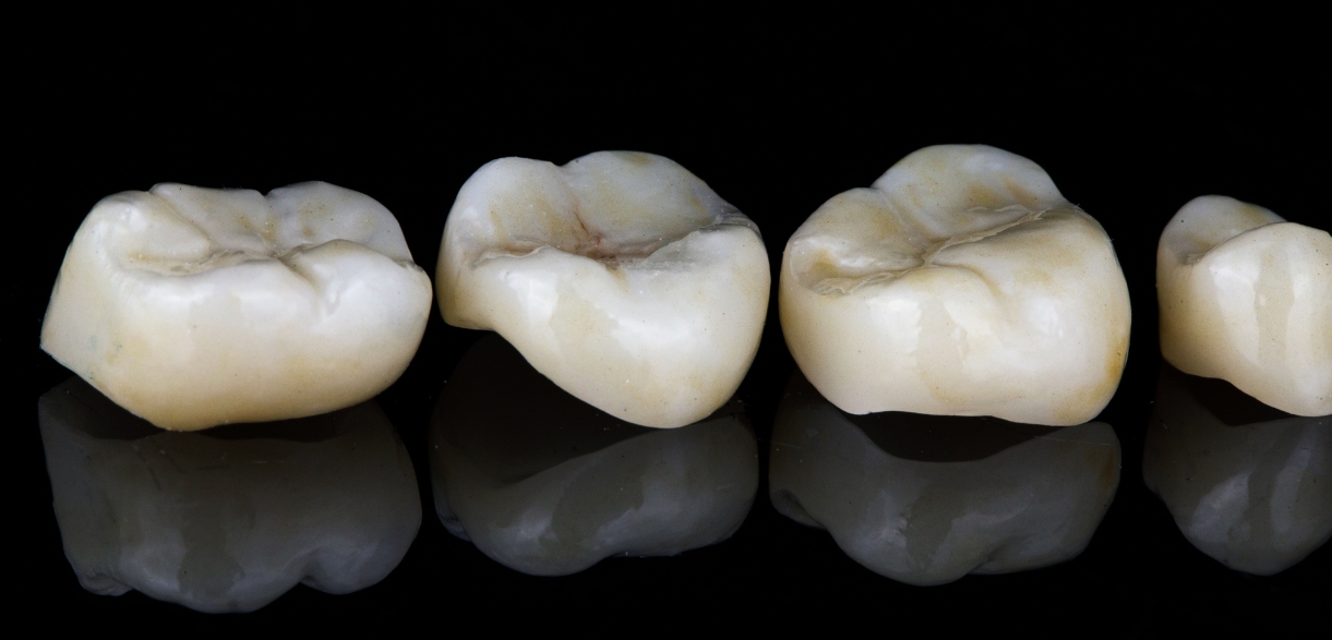 How to Care for Your Teeth After Getting Dental Crowns?